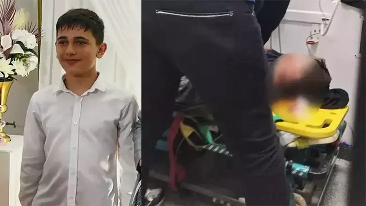 Büyükçekmece'de sac büküm makinesine kafası sıkışan çocuk yaşam savaşı veriyor