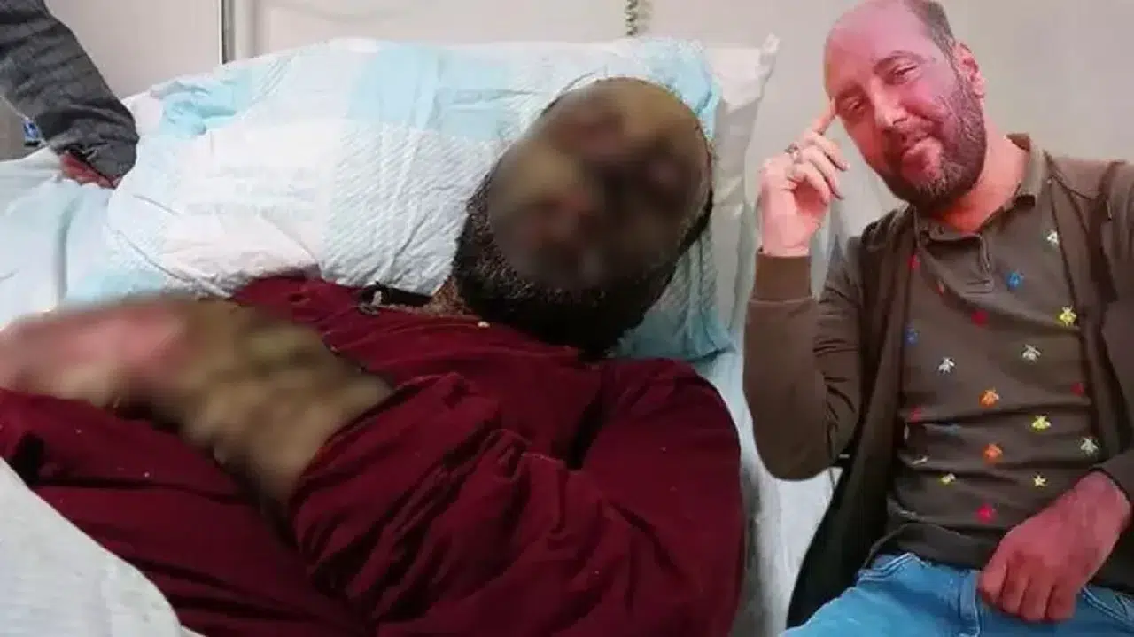 Erzurum'da Korona sonrası yağmur ormanı hastalığı vakası