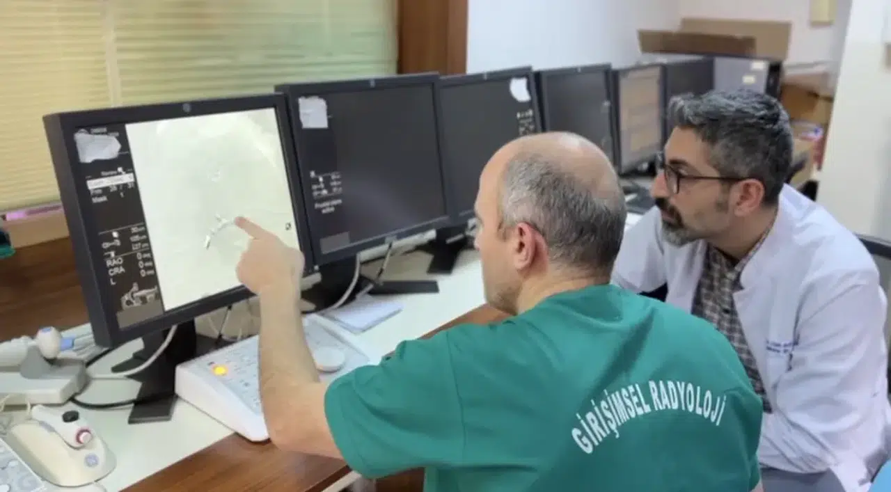 RTEÜ'de Transarteriyel Radyoembolizasyon (TARE) yöntemi kullanılmaya başlandı