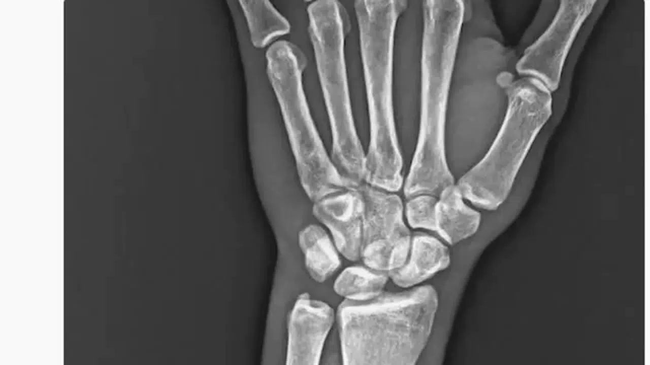 Trabzonspor'dan Onuachu'nun sakatlığına dair açıklama