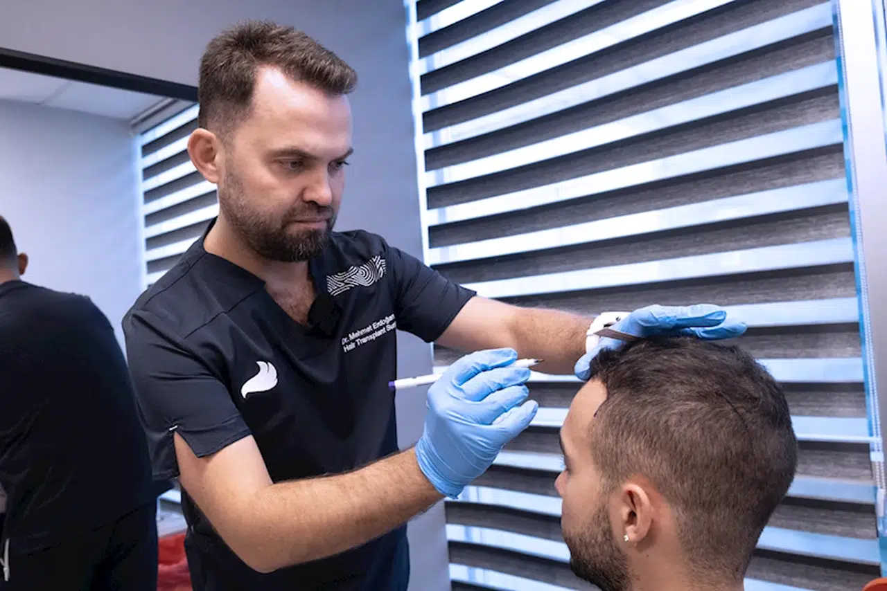 "Yaz aylarında da saç ekimi yapılabilir"