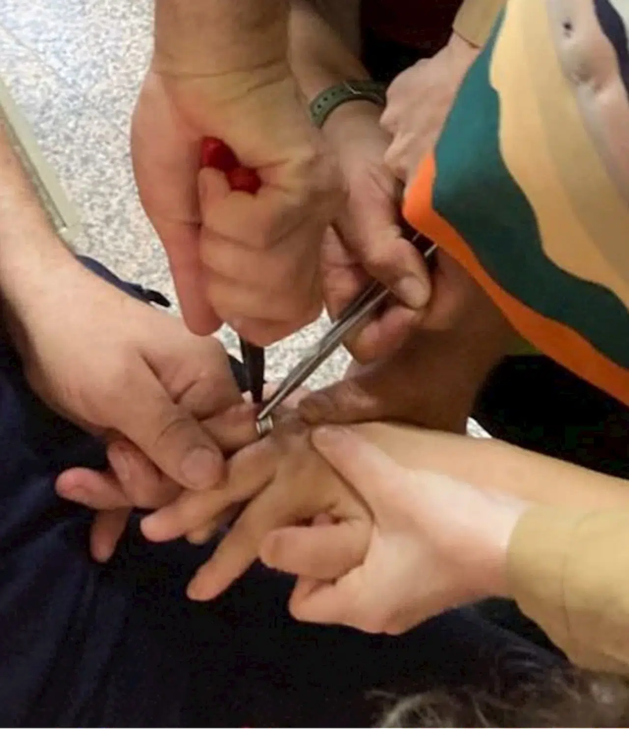 Zonguldak'ta parmağına yüzük sıkışan kadını itfaiye ekipleri kurtardı