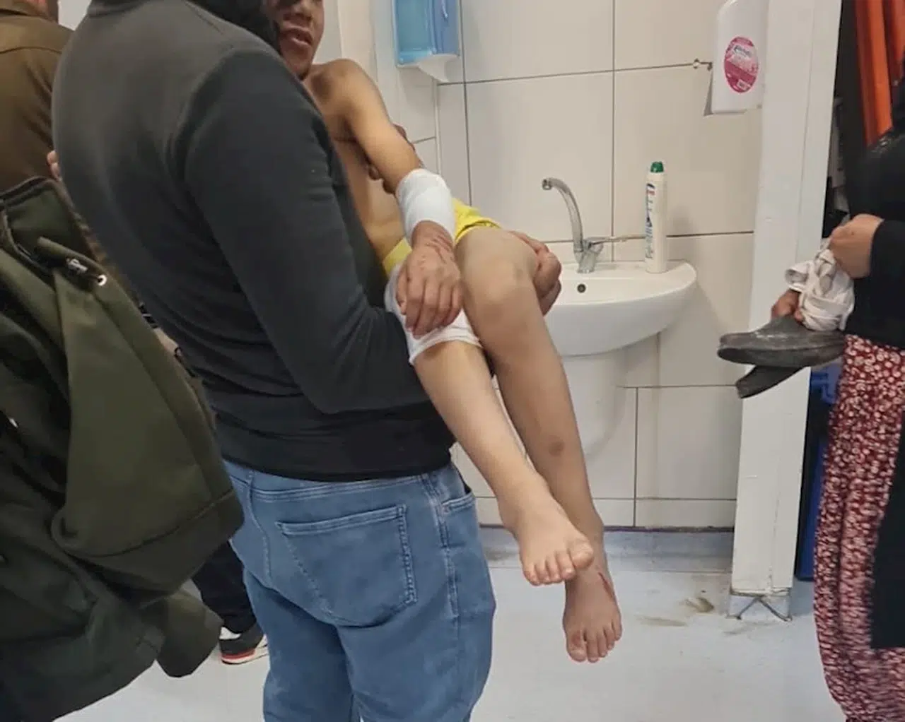 Malatya'da, sokakta oyun oynarken başıboş köpeklerin saldırısına uğrayan çocuk yaralandı