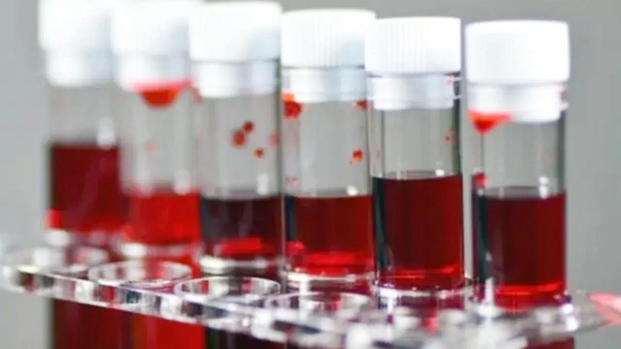 Rize'de A ve B Kan Grubu Olanlar Dikkat: Felç Riski Daha Yüksek!