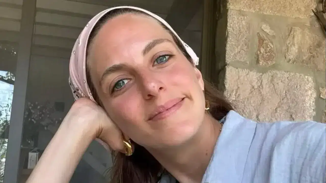 Ünlü Oyuncu Bige Önal Tatilde Akrep Sokmasıyla Hastaneye Kaldırıldı