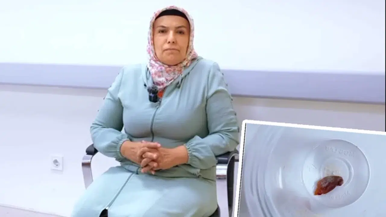 Kabak çekirdeği akciğere yapıştı, 1,5 yıl süren öksürüğün nedeni bu çıktı!
