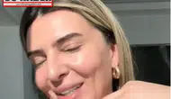 Survivor Merve Aydın’ın estetik paylaşımı olay oldu! 'Kimseyi kandıramazsın' yorumları yağdı