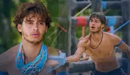 Survivor Yarışmasında Bacağını Kaybeden Yarışmacının Son Hali