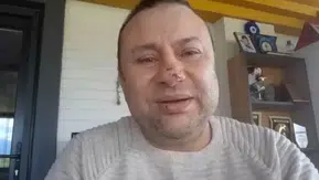 Onur Akay, Pitbull saldırısından sonra yeniden hayata tutundu: Entübe edildi!