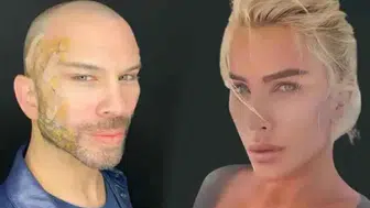 Berksan’ın Değişimi Gündemde! Eski Hali, Estetik İddiaları ve Son Görünümü Merak Ediliyor