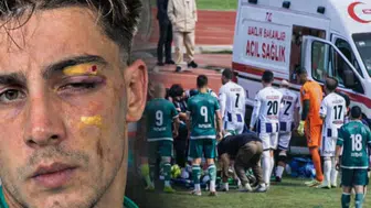 Rizeli Futbolcu Berat Vardal Maçta Sakatlandı: Yüzüne Krampon Darbesi Aldı