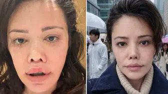 Yüz Nakli Üzerine Tartışma Büyüdü: Didem Ceran, Atilla Taş'ın Açıklamalarına Tepki Gösterdi!