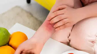 Sivrisineklerin Tercih Sebepleri: İnsanları Neden Hedef Alıyorlar?