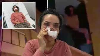 Tartıştığı eşinin burnunu ısırarak kopardı
