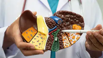 Karaciğeri sessizce bitiriyor! Komaya kadar götüren sirozu durdurmanın yolları