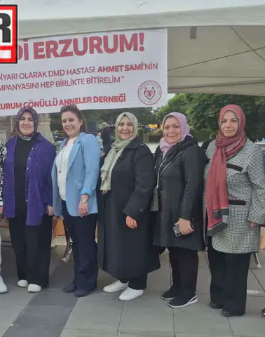 AK Parti Aziziye Kadın Kolları’ndan DMD Hastası Ahmet Sami İçin Düzenlenen Kermese Destek