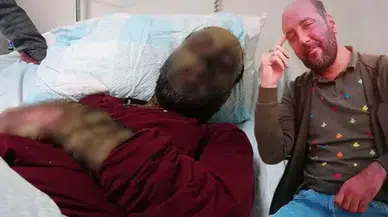 Erzurum'da Korona sonrası yağmur ormanı hastalığı vakası