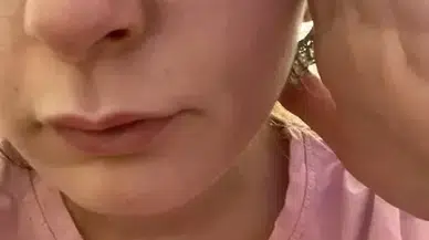 Sevgiliye 9 kafa darbesine 5 yıl 2 ay hapis