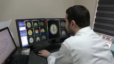 Trabzon'da beyin PET-BT tetkikiyle Alzheimer ve epilepsi erken teşhis edilecek