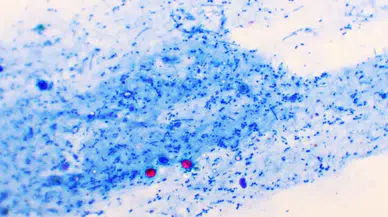 İngiltere’de su kaynaklı hastalık vakaları 46’ya yükseldi