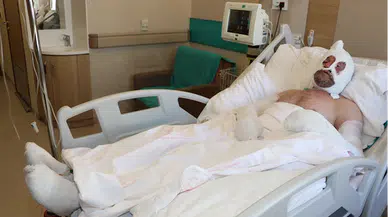 Sobanın yanında unuttuğu benzin bidonu canından ediyordu