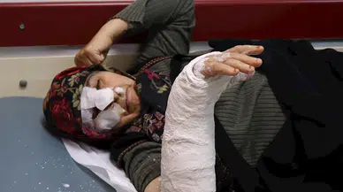 ERZURUM Saldıran sokak köpeklerinden kurtulmaya çalışırken merdivenlerden düşen kadının burnu ve kolu kırıldı (VİDEO EKLENDİ) 