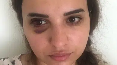 Bir yıldır boşanmak istediği eşi darbedip, bıçakladı