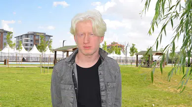   Albino hastası Emirhan:  İnsanlar farklı yaklaşımlar sergileyebiliyor 