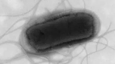 İngiltere’de gıdadan koli basili salgını: 113 vaka