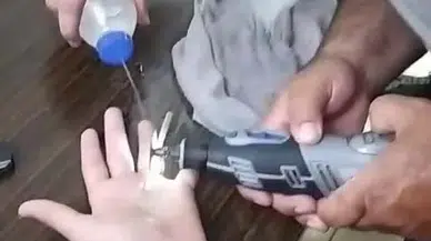 Parmağına sıkışan yüzüğü itfaiye çıkardı 