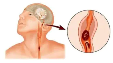 Bayburt İl Sağlık Müdürlüğü’nden hayati uyarı!