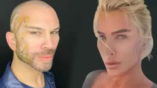 Berksan’ın Değişimi Gündemde! Eski Hali, Estetik İddiaları ve Son Görünümü Merak Ediliyor