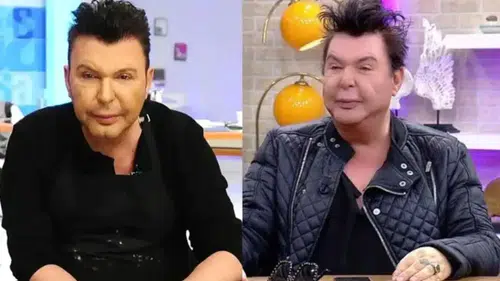 Kuşum Aydın’ın Son Hali Gündem Oldu: Ameliyat Sonrası Büyük Değişim