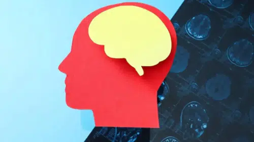 Alzheimer riskini arttıran besinler açıklandı! Meğer her gün tüketiliyormuş