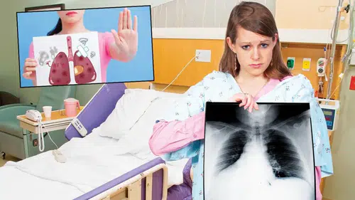 Kadınlarda Akciğer Kanseri Tehditleri Artıyor: Uzmanlardan Uyarılar!