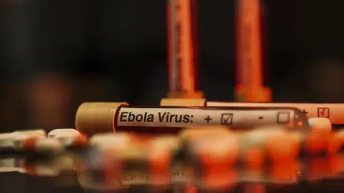 Kongo'da Ebola salgınında can kaybı 3 bin 577’ye yükseldi