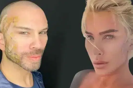 Berksan’ın Değişimi Gündemde! Eski Hali, Estetik İddiaları ve Son Görünümü Merak Ediliyor