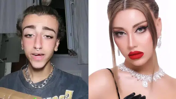 Mika Raun Öldü Mü? Mikail Can Kurnaz Hakkında Son Durum