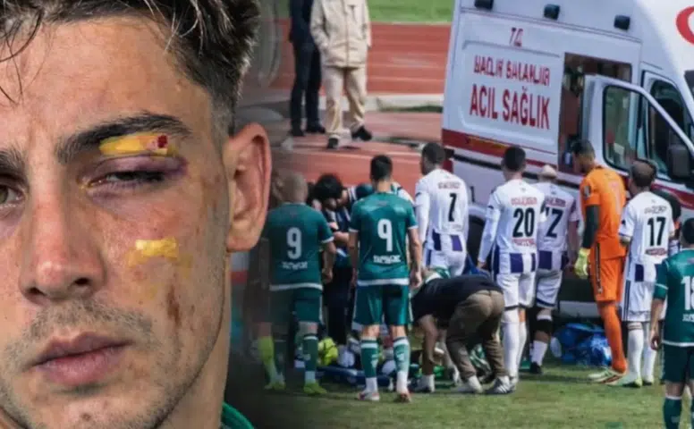 Rizeli Futbolcu Berat Vardal Maçta Sakatlandı: Yüzüne Krampon Darbesi Aldı