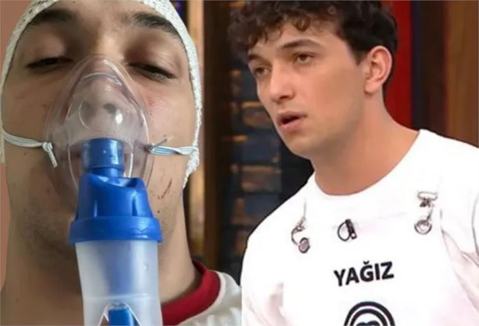 MasterChef yarışmacısı Yağız Özçelik korkunç kazayı anlattı! 