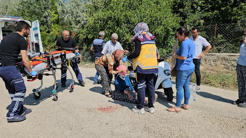 Elektrikli motosikletten düşüp yaralandı