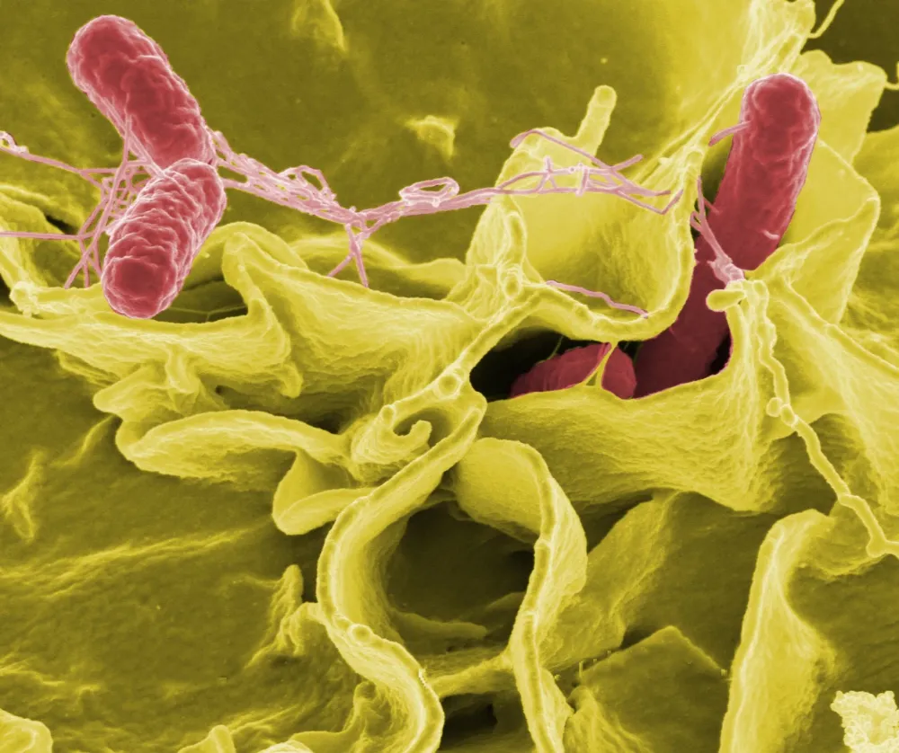 Servet Polat Ölüm Nedeni Salmonella mı? Bakteri Mi, Öldürücü Mü?