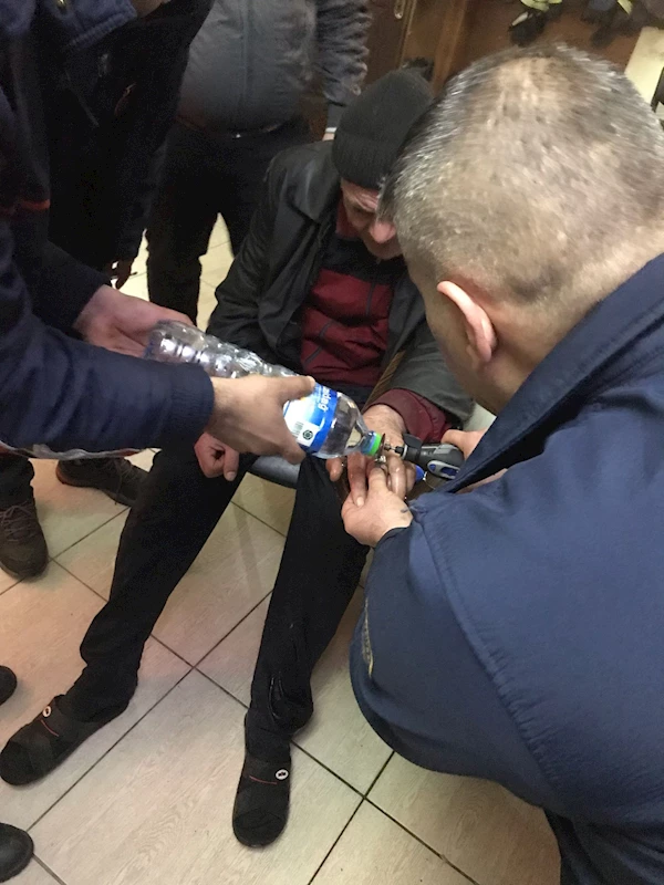 Parmağa sıkışan yüzüğü itfaiye ekibi çıkardı 