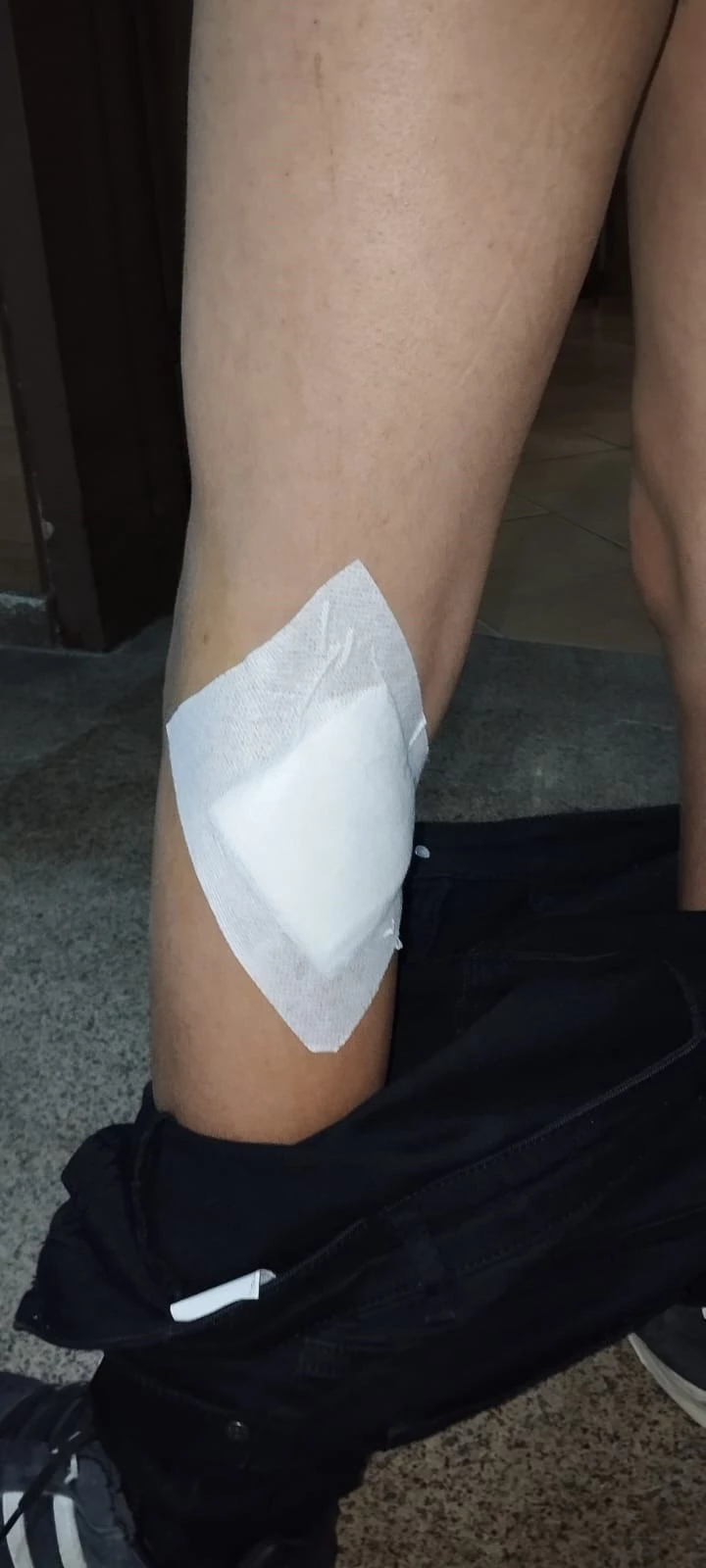 Başıboş köpekler 2 çocuğu ısırdı 